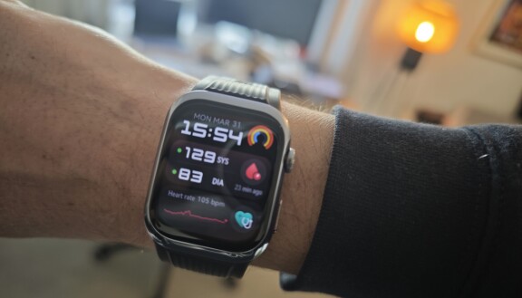 Test: Huawei Watch D2 – Förbluffande bra, mäter blodtryck på riktigt