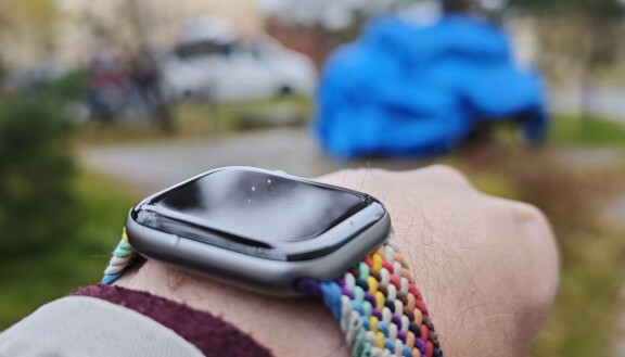 Test: Apple Watch Series 11 – Långsiktig förbättring